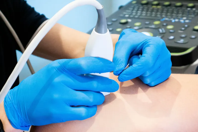 Manos con guantes: la sonda del ecógrafo en una y la aguja de punción en la otra